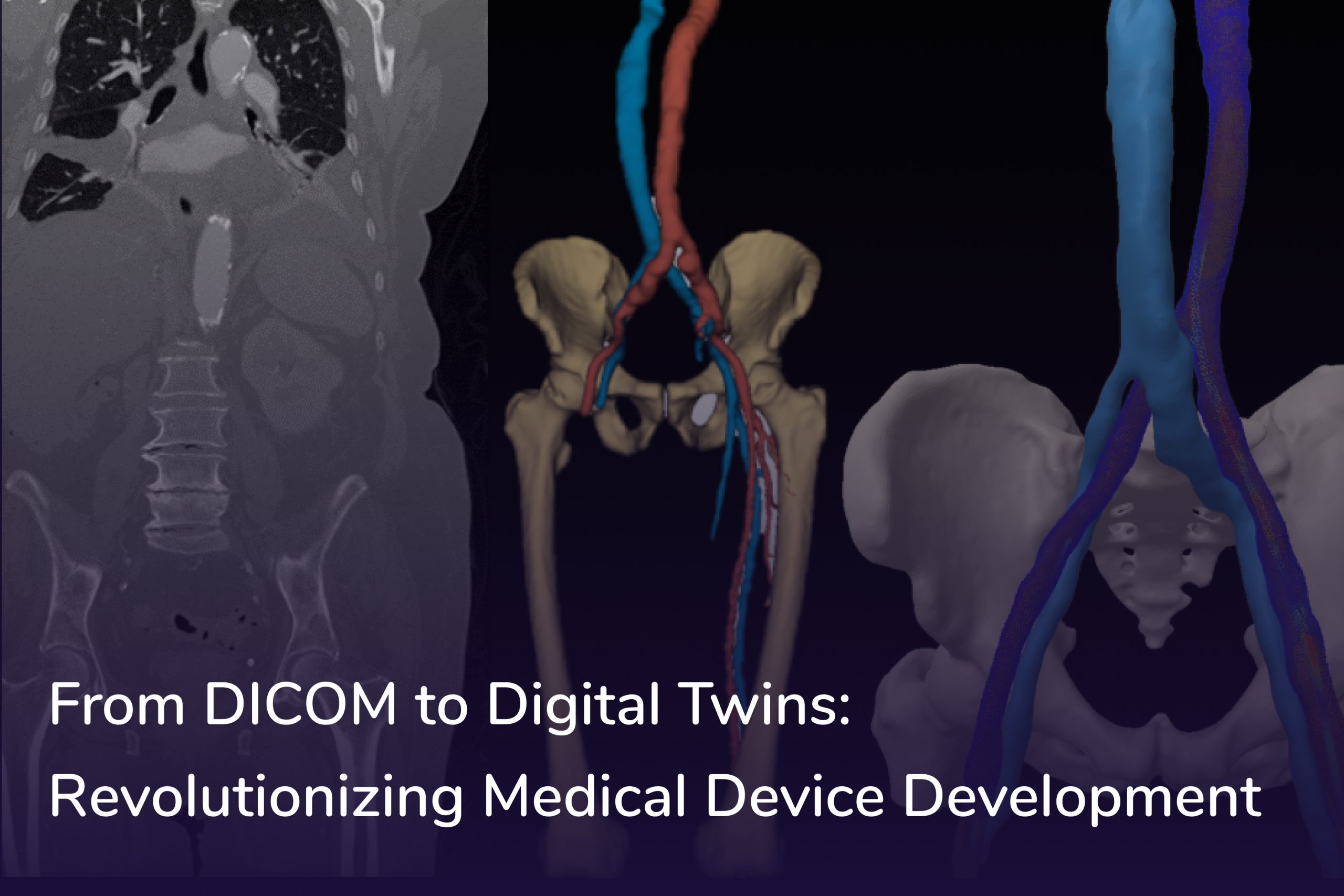 From DICOM to Digital Twins: Revolutionizing Medical Device Development